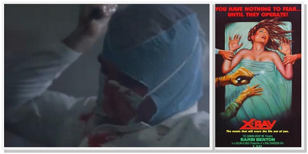 X-Ray 1981